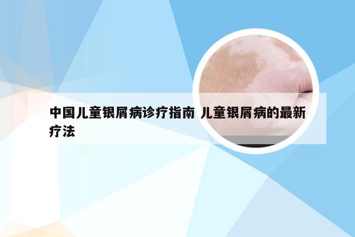 中国儿童银屑病诊疗指南 儿童银屑病的最新疗法