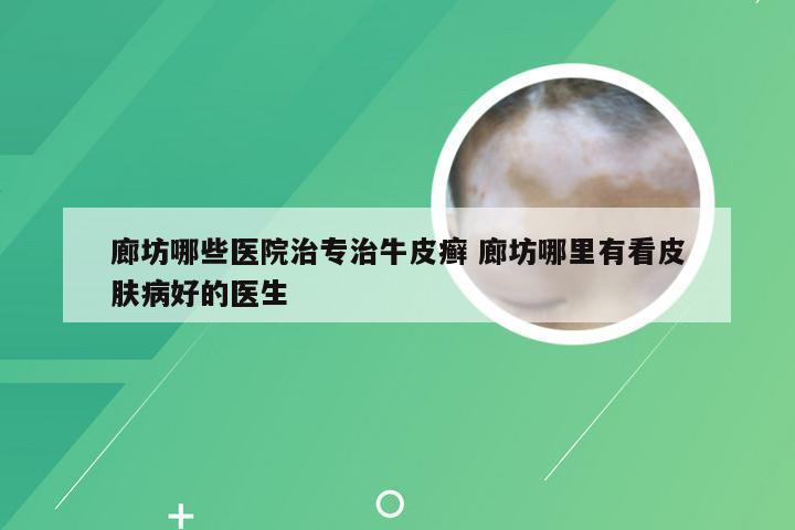 廊坊哪些医院治专治牛皮癣 廊坊哪里有看皮肤病好的医生