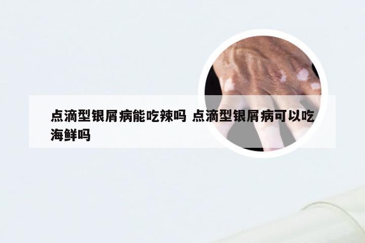 点滴型银屑病能吃辣吗 点滴型银屑病可以吃海鲜吗
