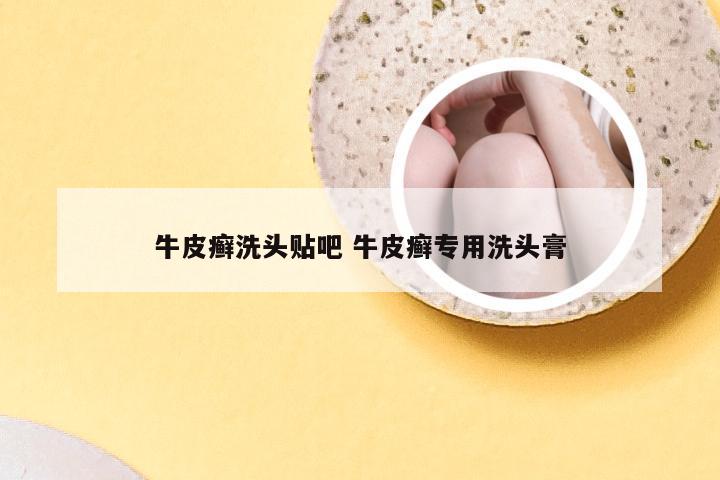 牛皮癣洗头贴吧 牛皮癣专用洗头膏