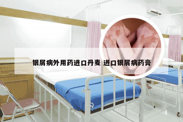 银屑病外用药进口丹麦 进口银屑病药膏