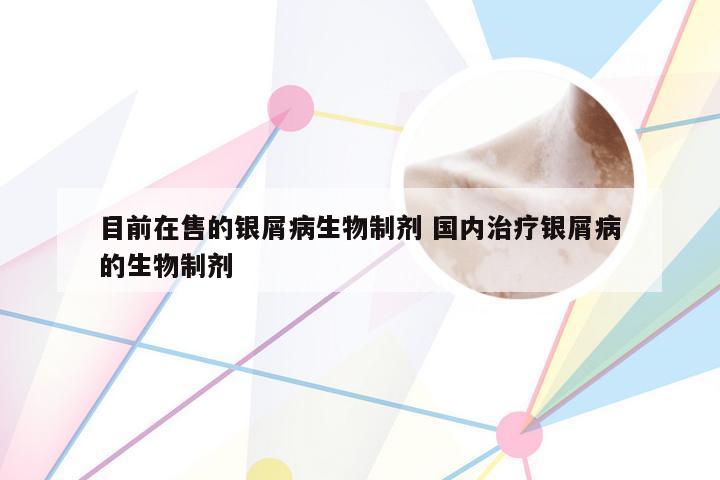 目前在售的银屑病生物制剂 国内治疗银屑病的生物制剂