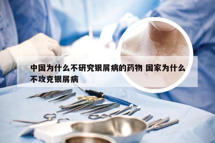 中国为什么不研究银屑病的药物 国家为什么不攻克银屑病
