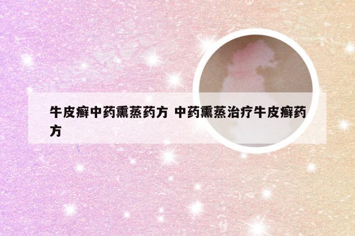 牛皮癣中药熏蒸药方 中药熏蒸治疗牛皮癣药方