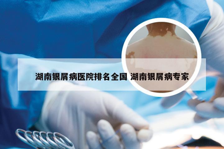 湖南银屑病医院排名全国 湖南银屑病专家