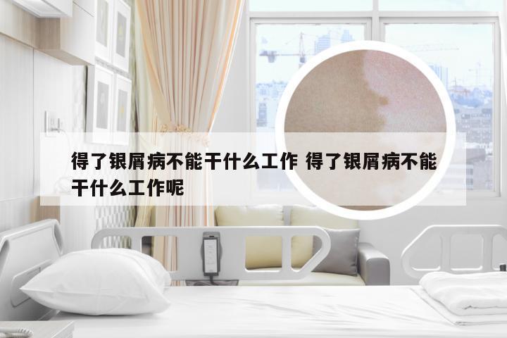得了银屑病不能干什么工作 得了银屑病不能干什么工作呢