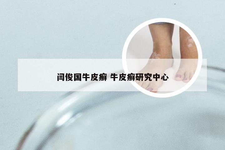 闫俊国牛皮癣 牛皮癣研究中心