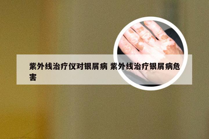 紫外线治疗仪对银屑病 紫外线治疗银屑病危害