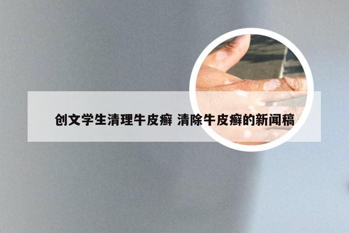 创文学生清理牛皮癣 清除牛皮癣的新闻稿