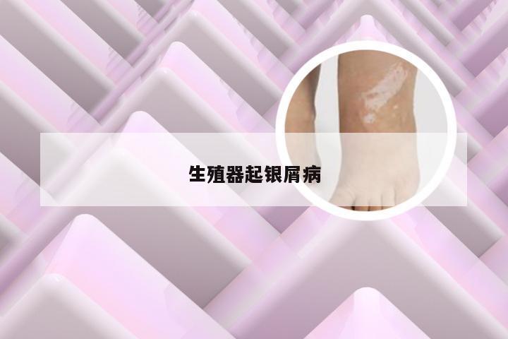 生殖器起银屑病