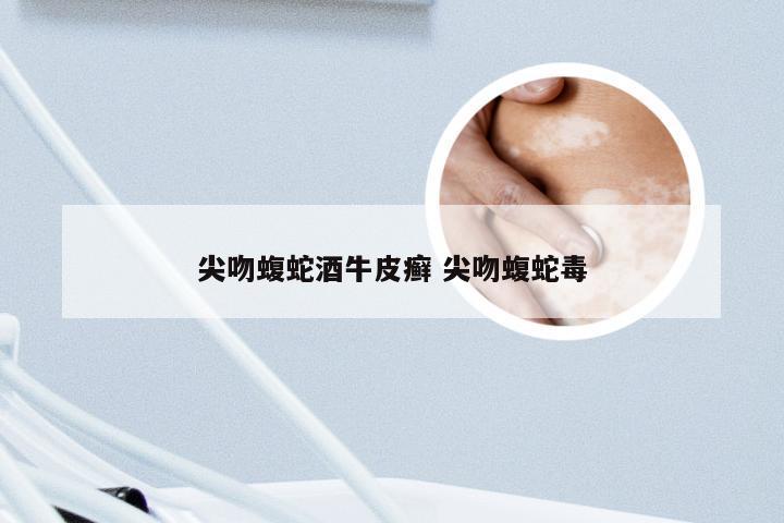 尖吻蝮蛇酒牛皮癣 尖吻蝮蛇毒