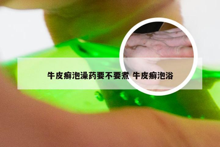 牛皮癣泡澡药要不要煮 牛皮癣泡浴