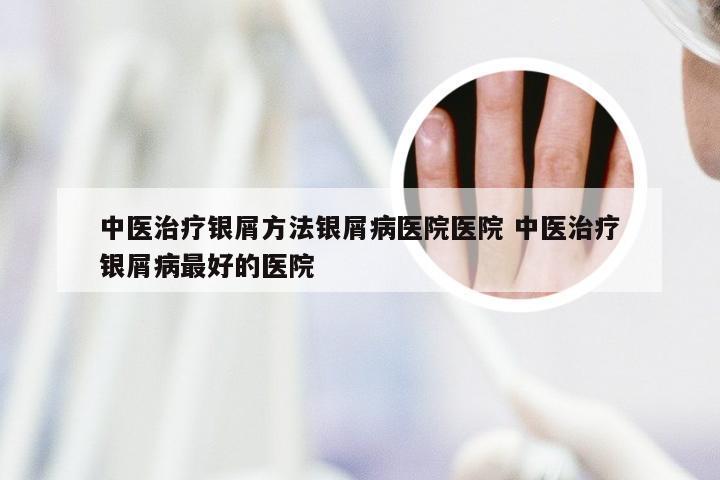 中医治疗银屑方法银屑病医院医院 中医治疗银屑病最好的医院