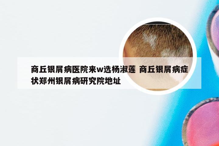 商丘银屑病医院来w选杨淑莲 商丘银屑病症状郑州银屑病研究院地址