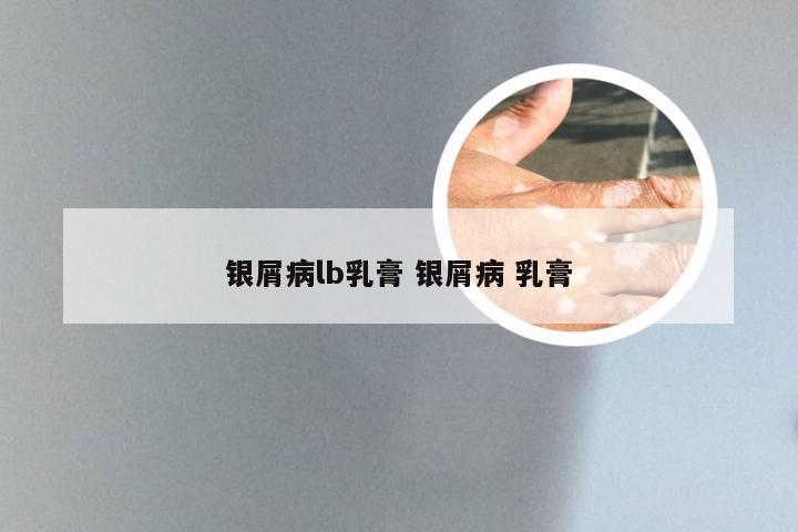 银屑病lb乳膏 银屑病 乳膏