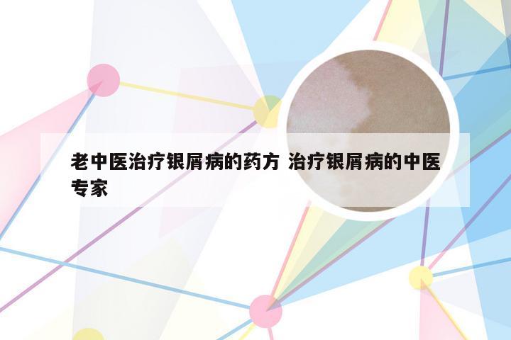 老中医治疗银屑病的药方 治疗银屑病的中医专家