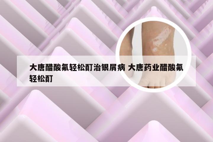 大唐醋酸氟轻松酊治银屑病 大唐药业醋酸氟轻松酊