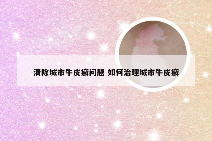 清除城市牛皮癣问题 如何治理城市牛皮癣