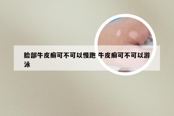 脸部牛皮癣可不可以慢跑 牛皮癣可不可以游泳