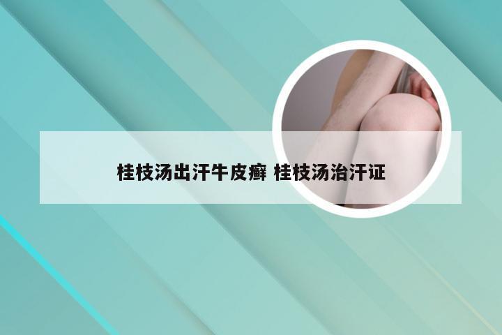 桂枝汤出汗牛皮癣 桂枝汤治汗证