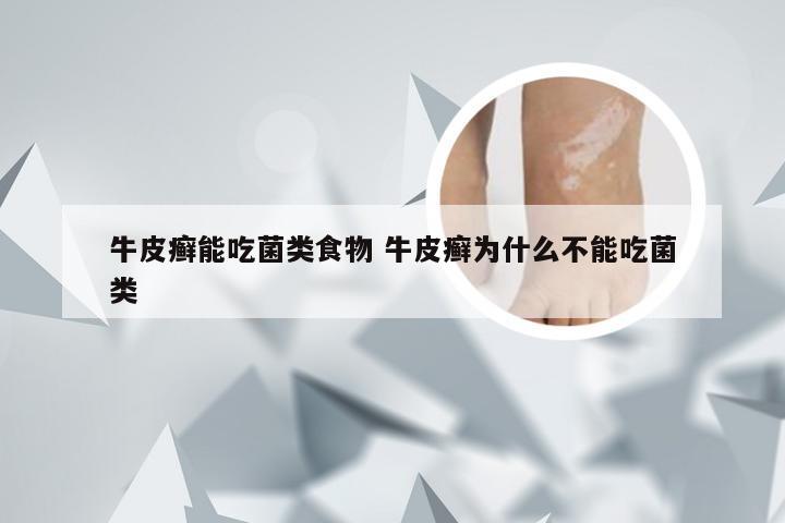 牛皮癣能吃菌类食物 牛皮癣为什么不能吃菌类