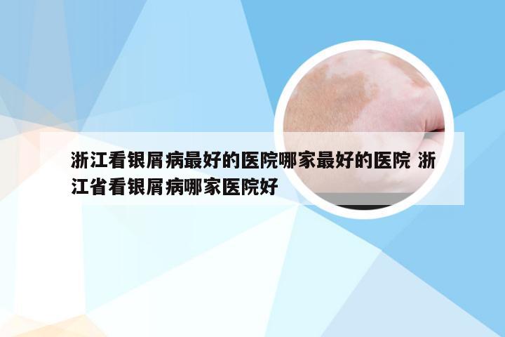 浙江看银屑病最好的医院哪家最好的医院 浙江省看银屑病哪家医院好