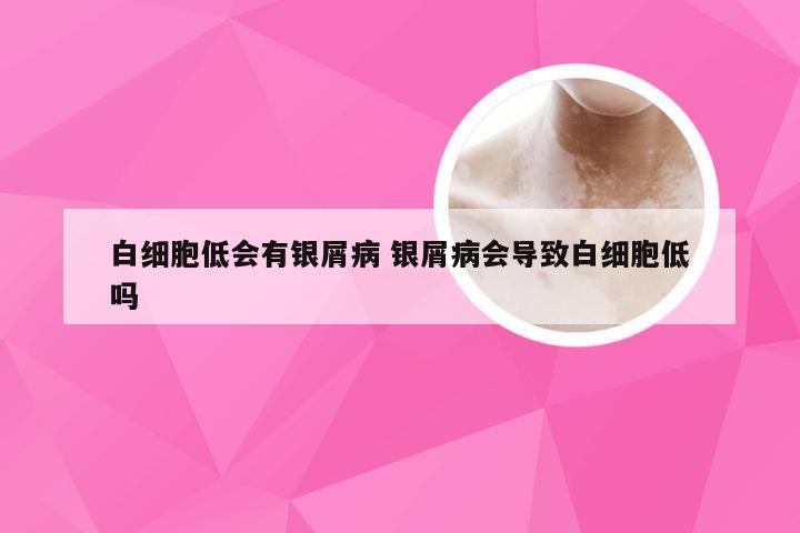 白细胞低会有银屑病 银屑病会导致白细胞低吗