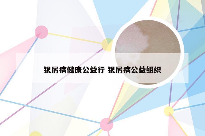 银屑病健康公益行 银屑病公益组织
