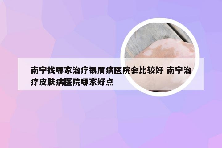 南宁找哪家治疗银屑病医院会比较好 南宁治疗皮肤病医院哪家好点