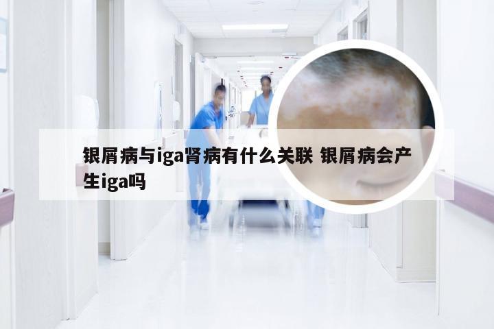 银屑病与iga肾病有什么关联 银屑病会产生iga吗