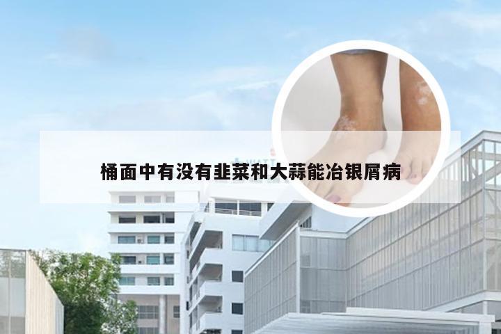 桶面中有没有韭菜和大蒜能冶银屑病
