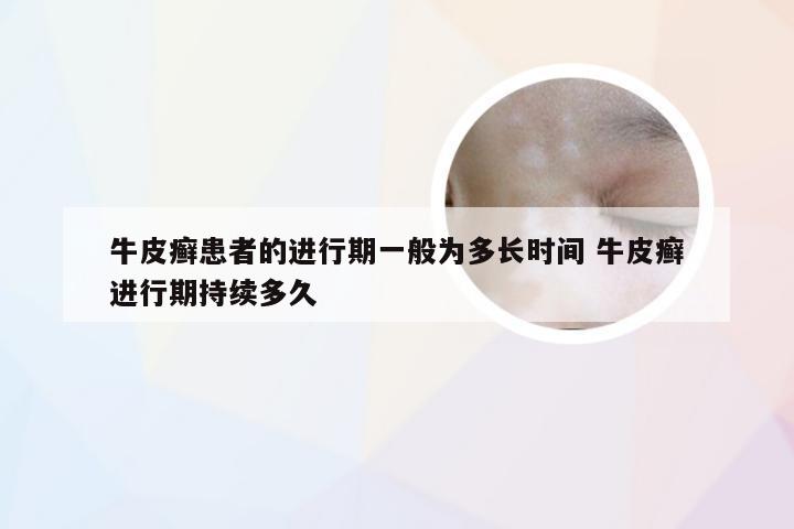 牛皮癣患者的进行期一般为多长时间 牛皮癣进行期持续多久