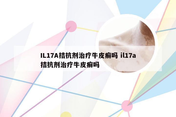 IL17A拮抗剂治疗牛皮癣吗 il17a拮抗剂治疗牛皮癣吗