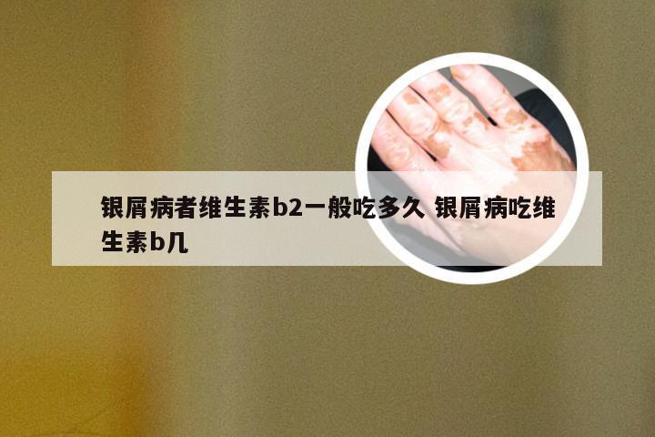 银屑病者维生素b2一般吃多久 银屑病吃维生素b几