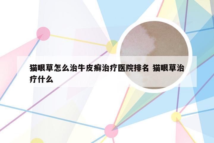猫眼草怎么治牛皮癣治疗医院排名 猫眼草治疗什么