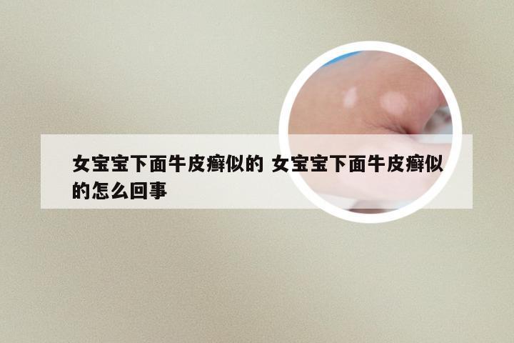 女宝宝下面牛皮癣似的 女宝宝下面牛皮癣似的怎么回事