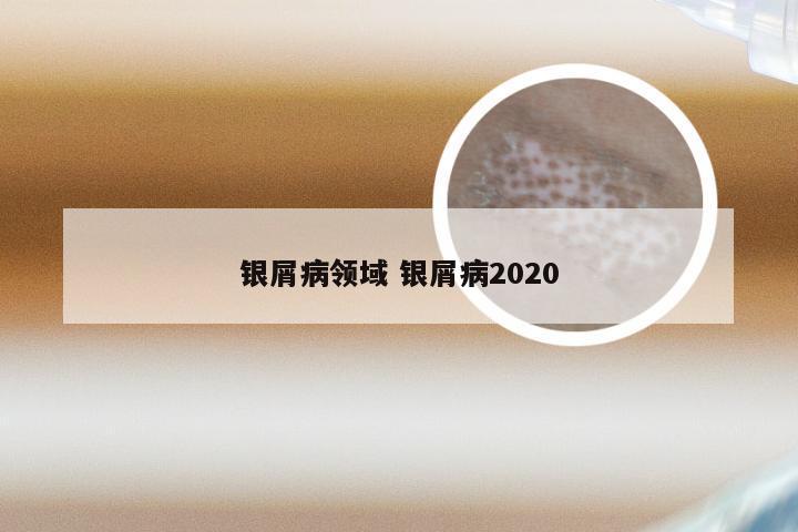 银屑病领域 银屑病2020