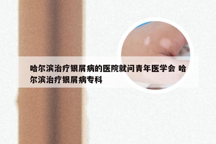 哈尔滨治疗银屑病的医院就问青年医学会 哈尔滨治疗银屑病专科