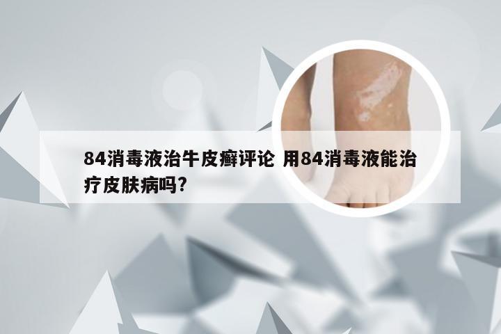 84消毒液治牛皮癣评论 用84消毒液能治疗皮肤病吗?