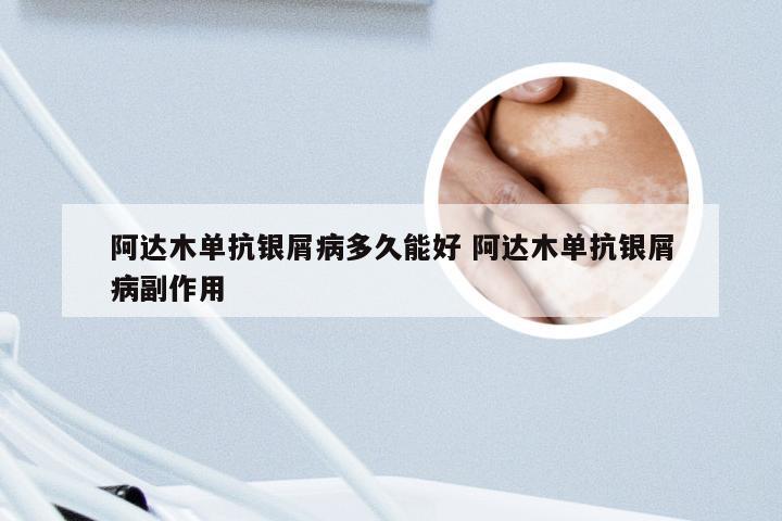阿达木单抗银屑病多久能好 阿达木单抗银屑病副作用