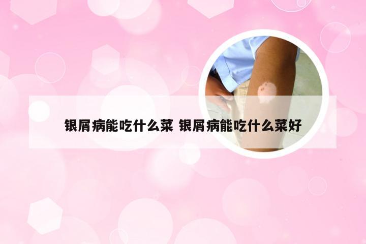 银屑病能吃什么菜 银屑病能吃什么菜好