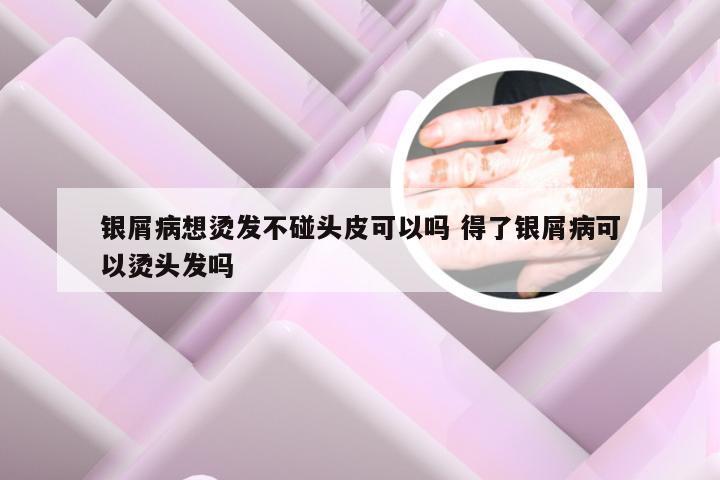 银屑病想烫发不碰头皮可以吗 得了银屑病可以烫头发吗