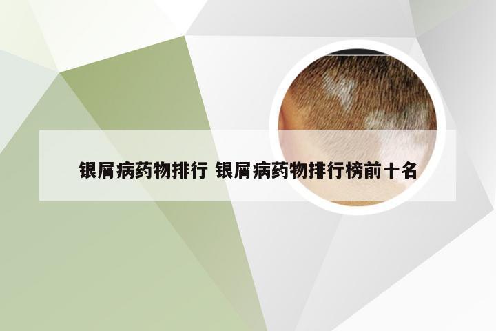 银屑病药物排行 银屑病药物排行榜前十名