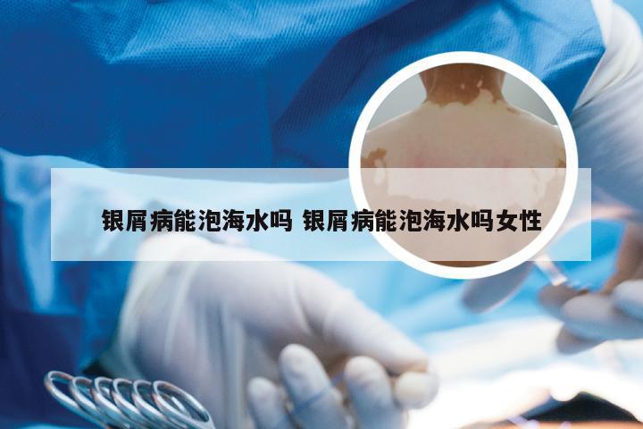 银屑病能泡海水吗 银屑病能泡海水吗女性