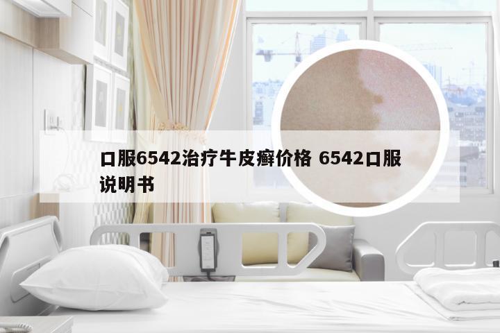 口服6542治疗牛皮癣价格 6542口服说明书