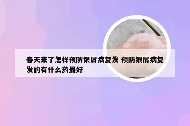 春天来了怎样预防银屑病复发 预防银屑病复发的有什么药最好