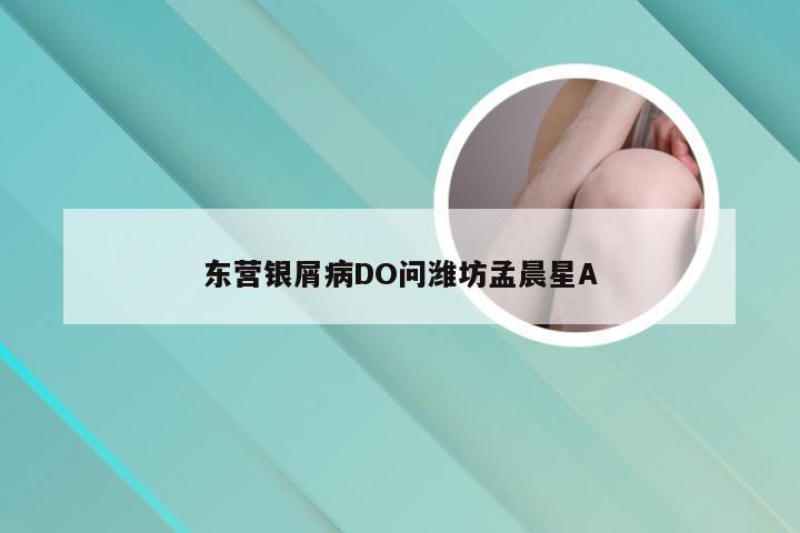 东营银屑病DO问潍坊孟晨星A