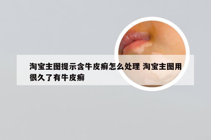 淘宝主图提示含牛皮癣怎么处理 淘宝主图用很久了有牛皮癣