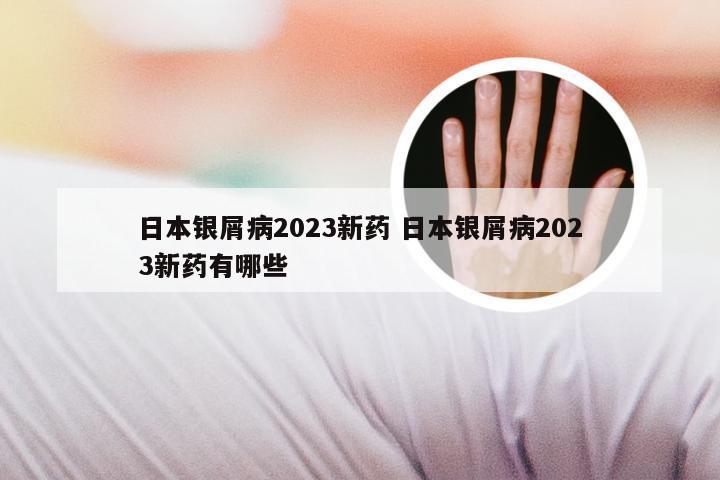 日本银屑病2023新药 日本银屑病2023新药有哪些
