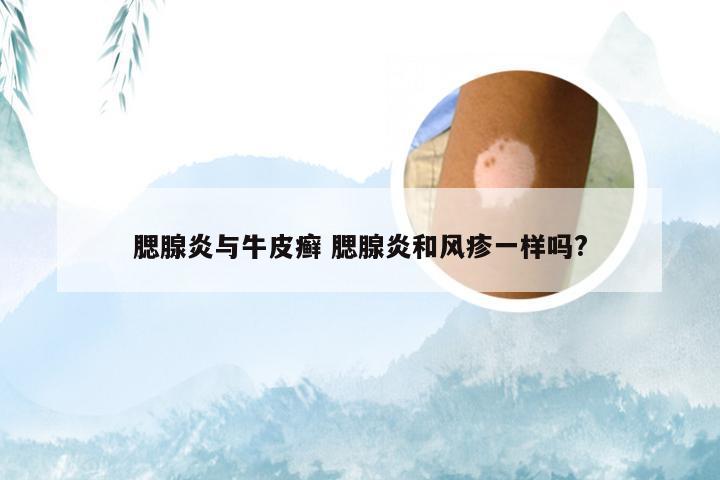腮腺炎与牛皮癣 腮腺炎和风疹一样吗?